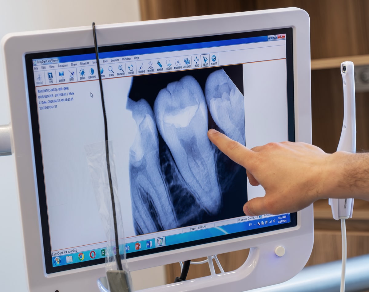 dr chung pointing to a dental xray